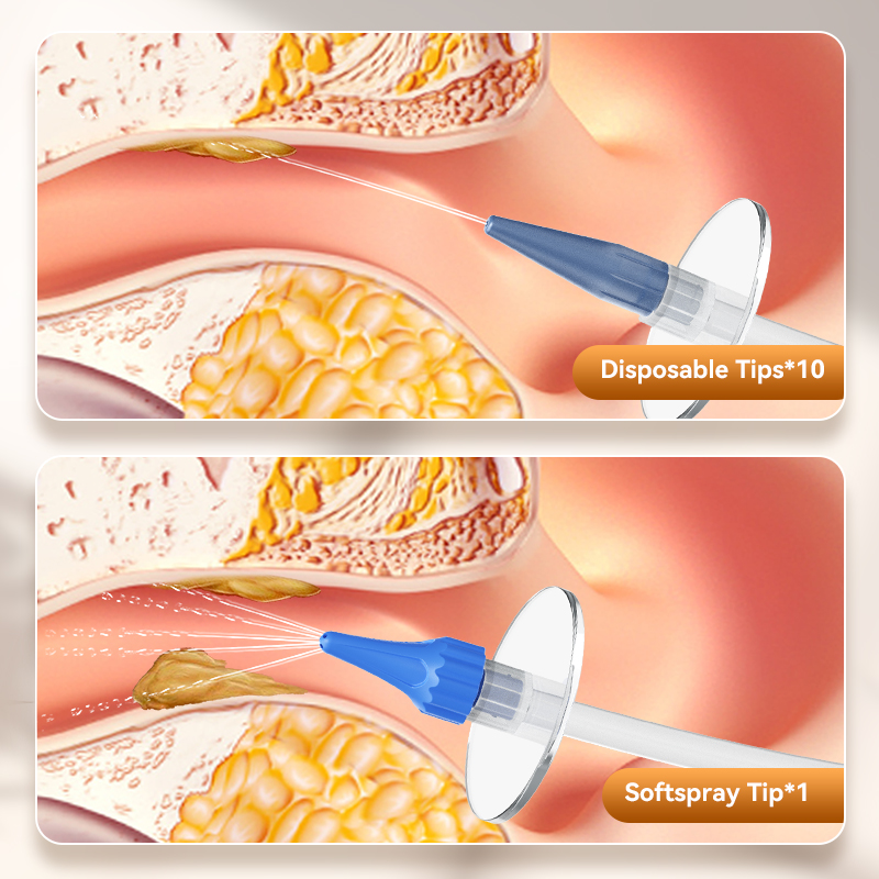 Ear Wax Removal Manual Oor Irr - Urban Farming System recensie en prijs